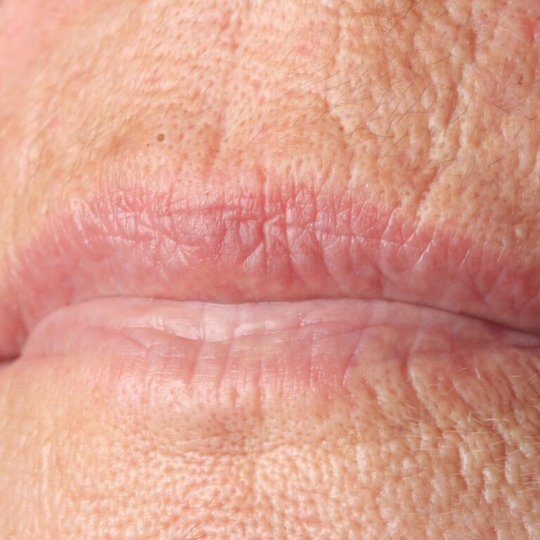 Huulirypyt
