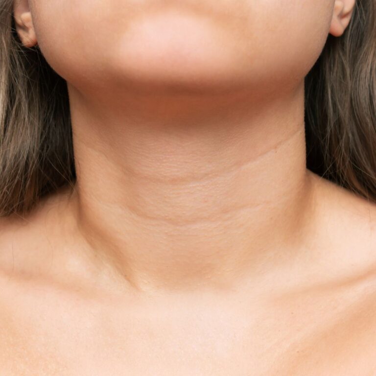Nefertiti Lift