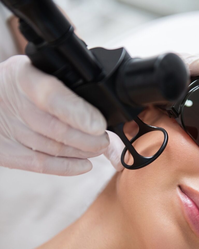 Alma Hybrid -laser, uuden sukupolven laserhoito ihon kokonaisvaltaiseen uudistamiseen