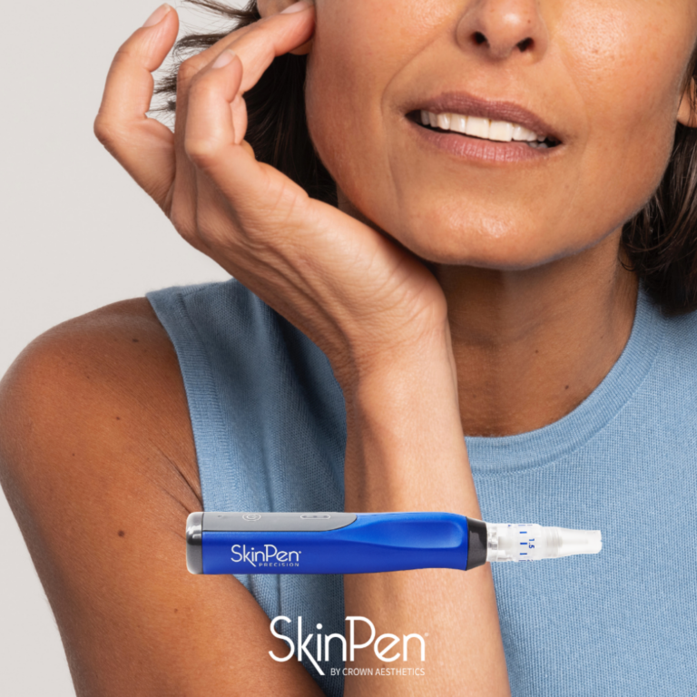 SkinPen-mikroneulaus – tehokas hoito ihon uudistamiseen